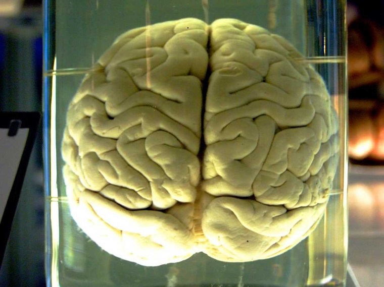 Ученые из США вырастили искусственный мозг из миндалин, гиппокампа и предлобной коры