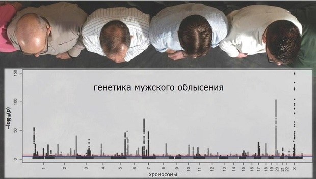 Профессионалы узнали, какие гены виноваты в облысении