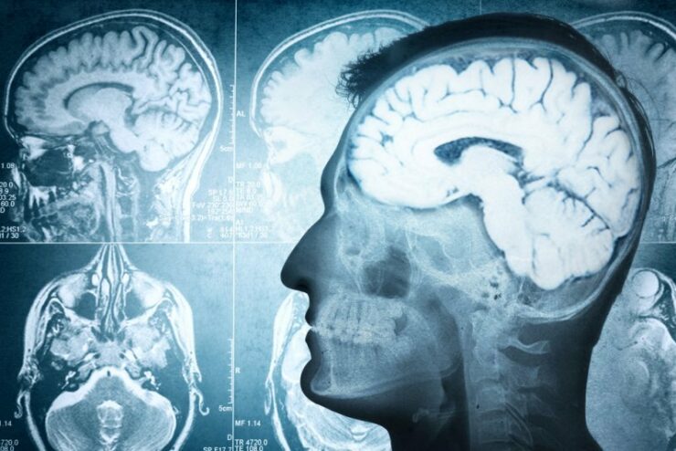 Как показывают исследования, словесное издевательство отрицательно влияет на структуру мозга