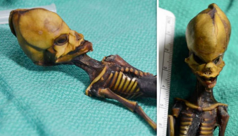 «Инопланетянин» из пустыни Атакама оказался младенцем с генетическими нарушениями
