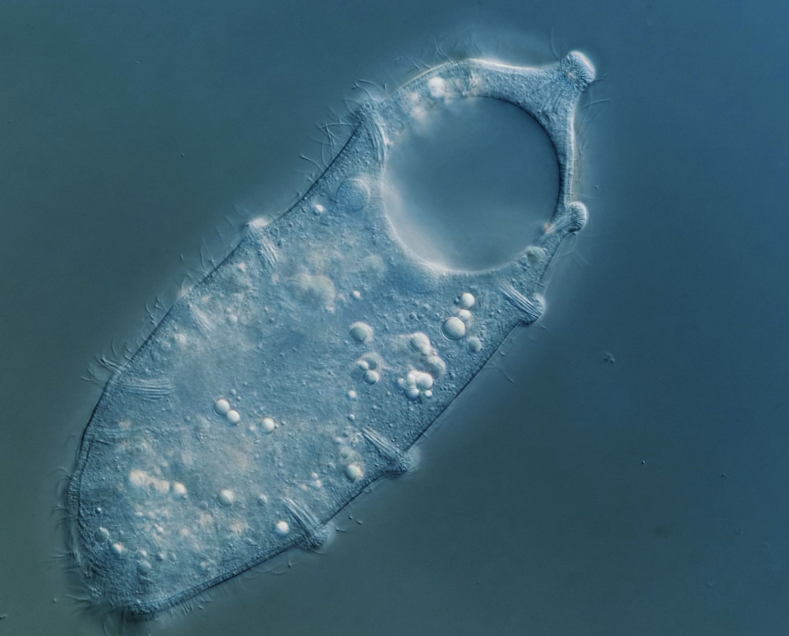 На этой микроскопической фотографии показан новый Lacerus с зазубренным краем клетки. Предоставлено: Борнмутский университет.