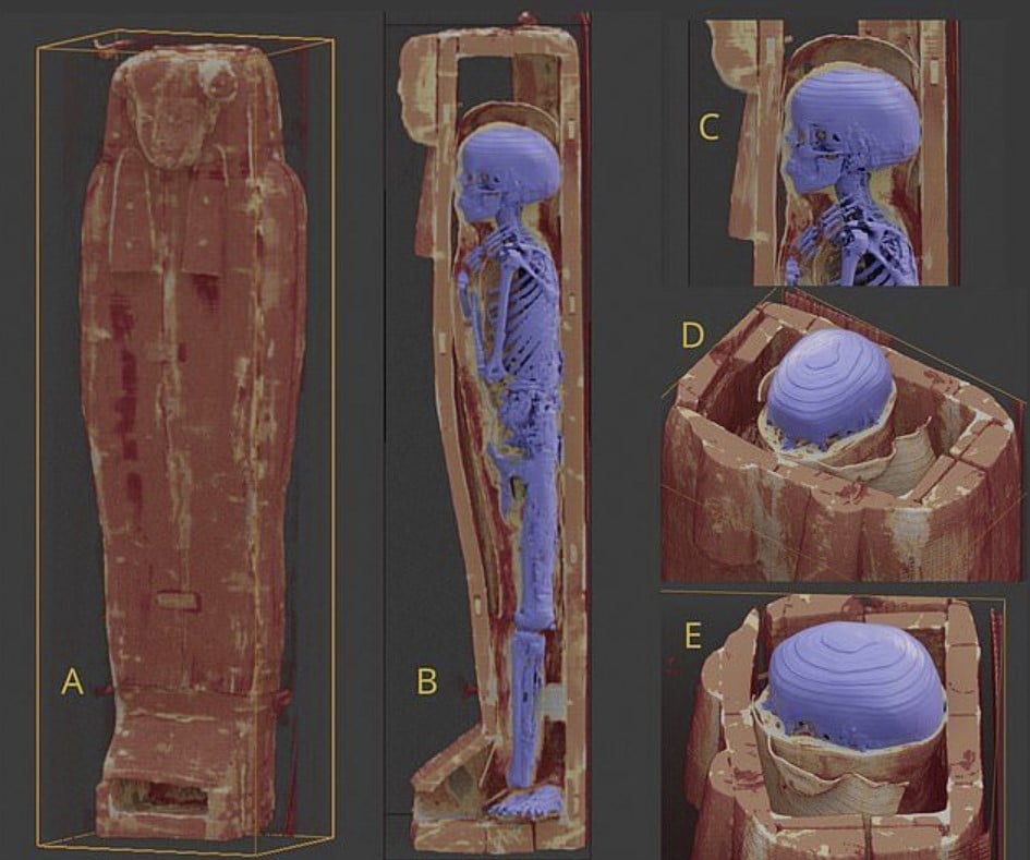 Древние пришельцы: обнаружена еще одна египетская мумия с “аномально большим мозгом”