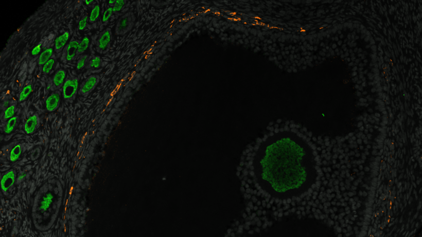 Раскрывая тайны яичников: карта развития яичникового резерва может привести к прорывам в лечении бесплодия