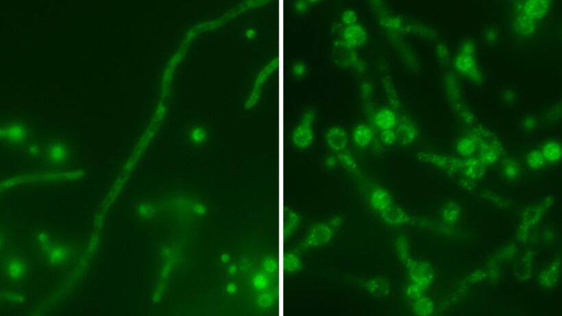 Вирус внутри грибка: Секретное оружие против смертельно опасной инфекции