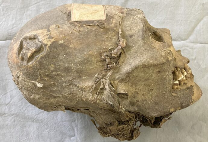 Загадка боливийской мумии: раскрыта тайна древнего черепа с трепанацией