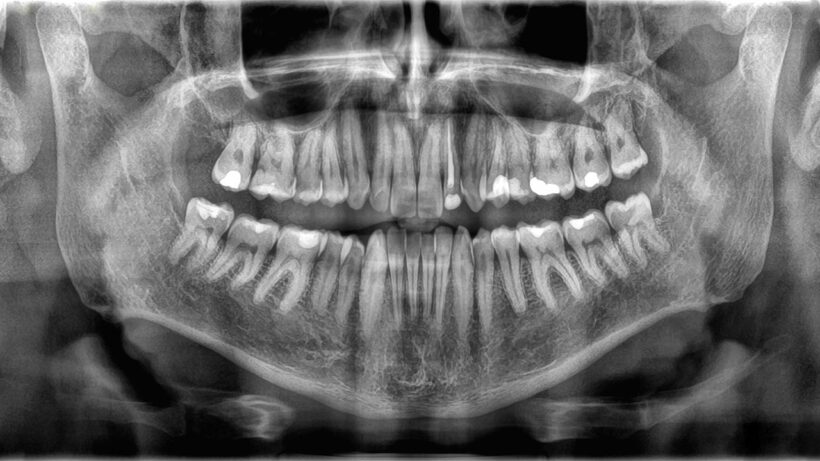 Не кости, а сокровище: Удивительная правда о наших зубах