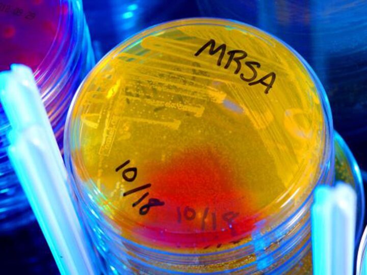 Новый Прорыв в Антибиотикотерапии: Открытие Первого Представителя Нового Класса Антибиотиков