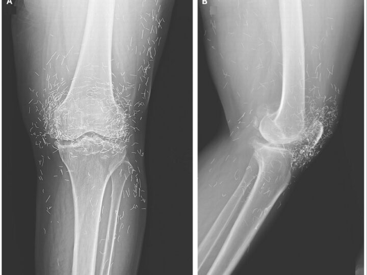 Диагностическая головоломка: 12 самых загадочных медицинских случаев года