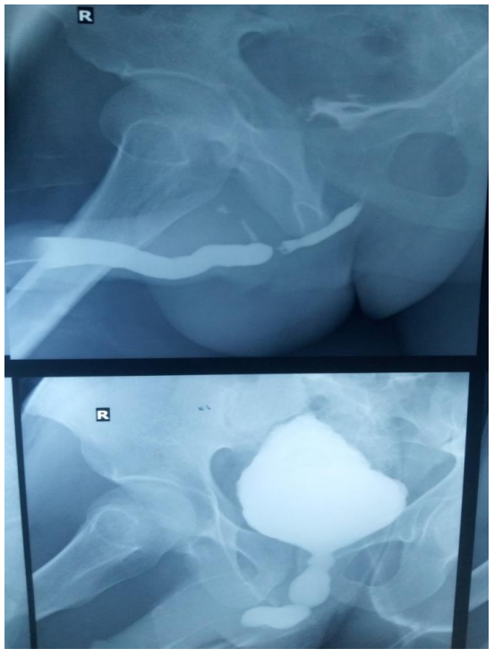 Загадочный случай: «Поливальная лейка» и «Рождественская ель» в одном организме