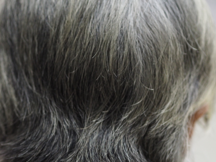 Седина как щит: как организм жертвует цветом волос, защищаясь от рака