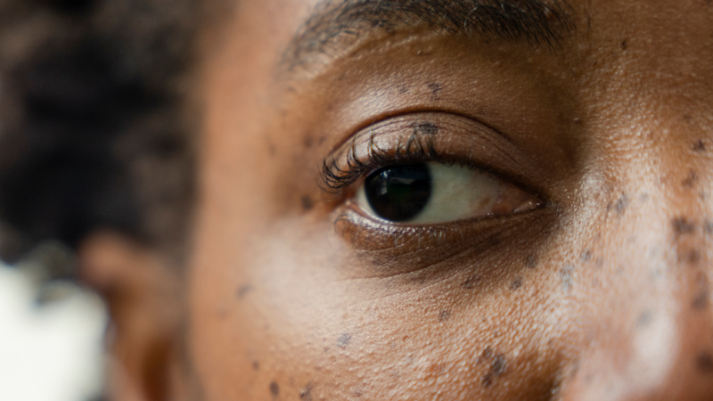 «Перезагрузка» зрения: как «отключение» ленивого глаза может восстановить зрение у взрослых