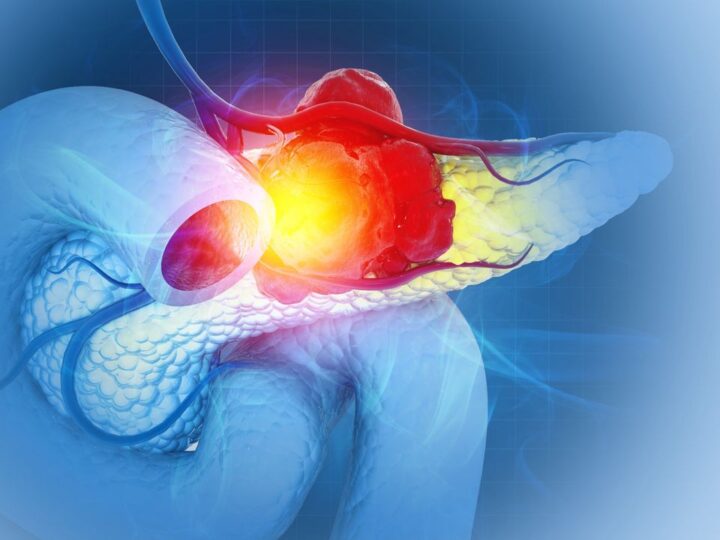 Тройной удар по раку поджелудочной железы: новая комбинация лекарств показала 100% эффективность у мышей