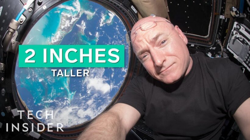 Космическая деформация: как долгие полеты заставляют мозг «парить» и смещаться внутри черепа