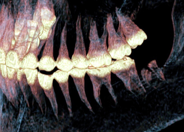 Сибирский хирург железного века: как кочевник с конским волосом спас женщину 2500 лет назад