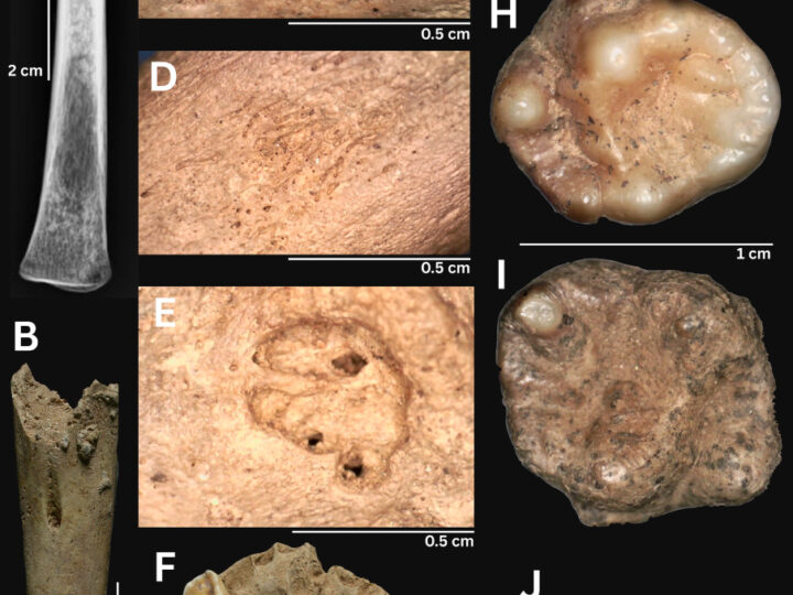 Не только Америка: найденные во Вьетнаме скелеты переворачивают теорию происхождения сифилиса