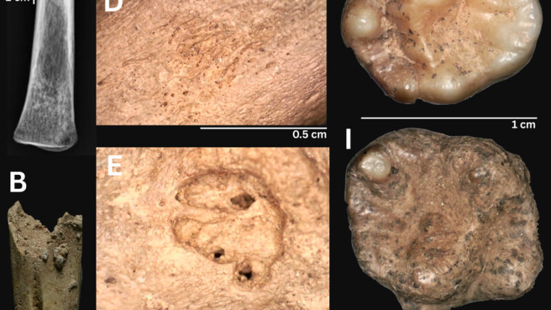 Не только Америка: найденные во Вьетнаме скелеты переворачивают теорию происхождения сифилиса