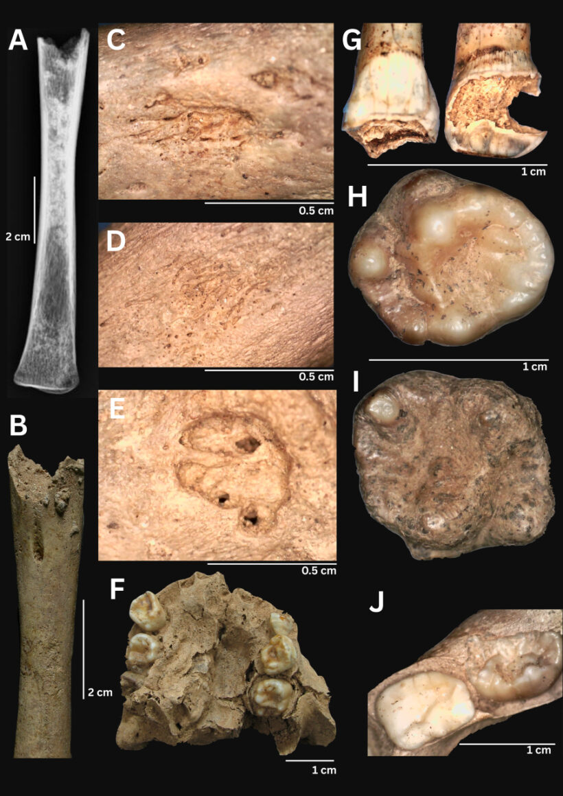 Не только Америка: найденные во Вьетнаме скелеты переворачивают теорию происхождения сифилиса